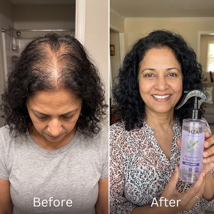 Rosemary + Rice Water Spray